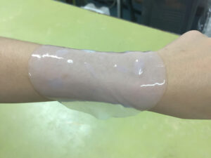 Arm mit Cellulose aus Bakterieller Cellulose. Bildrechte Kallayanee-stock.adobe.com 
